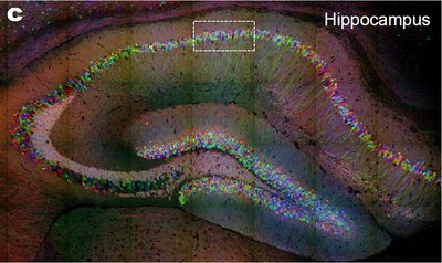Hippocampal neuronal cell types stained with fluorescent proteins