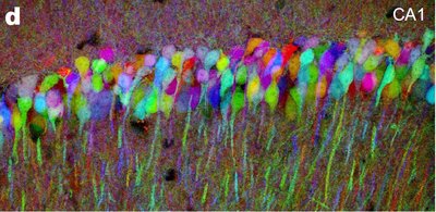 CA1 region of hippocampus with labeled neurons