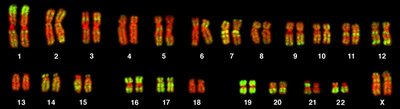 Human karyotype