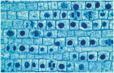 Cells in different phases of mitosis
