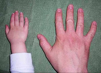 Child and adult hand comparison