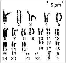 Human karyotype