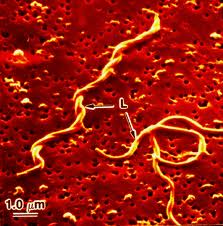 Bacterium with multiple flagella