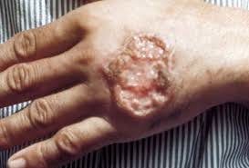 Leishmania life cycle