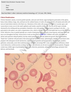 Blood smear showing sickle cells