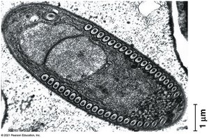 Microsporidian cell structure