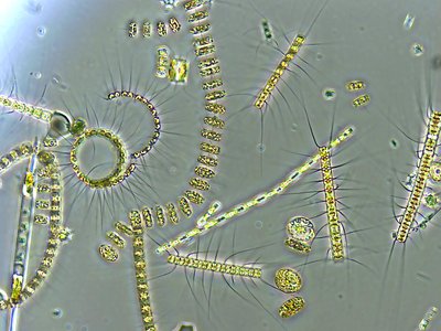 Microscopic view of phytoplankton, primary producers in aquatic ecosystems