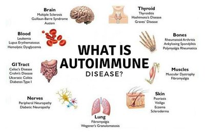 Overview of autoimmune diseases affecting different organs