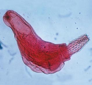 Platyhelminthes example