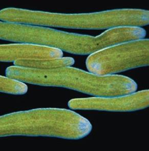 Platyhelminthes example