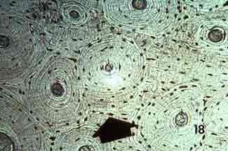 Bone tissue micrograph