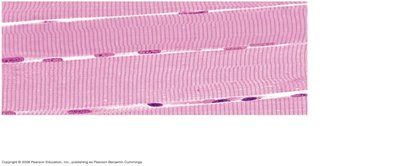 Skeletal muscle micrograph