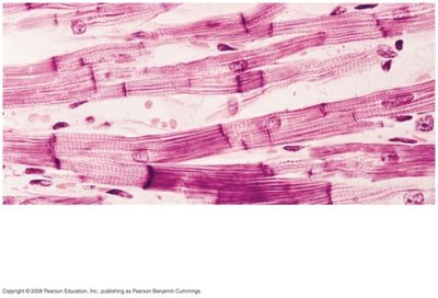 Cardiac muscle micrograph