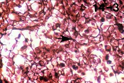 Loose connective tissue with labeled cells and fibers