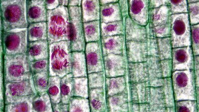 Interphase in onion root tip