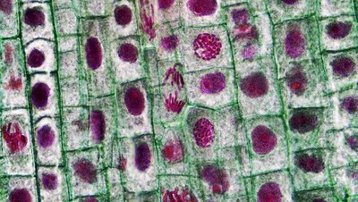 Prophase in onion root tip
