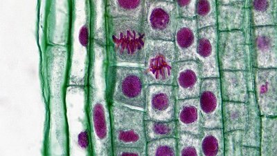 Metaphase in onion root tip