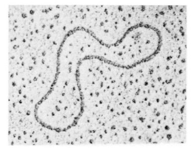 Prokaryotic DNA under microscope