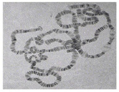 Eukaryotic DNA under microscope