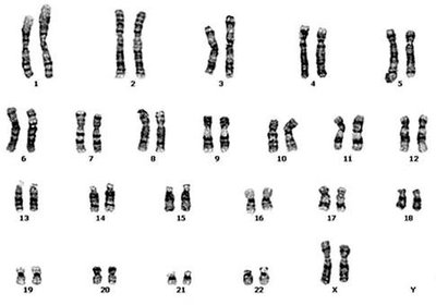 Human karyotype