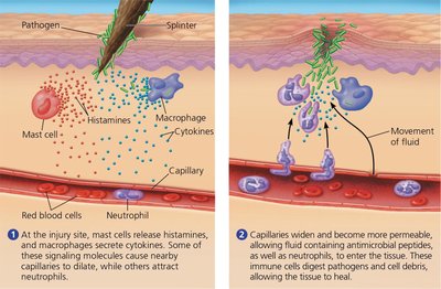 Diagram of the local inflammatory response