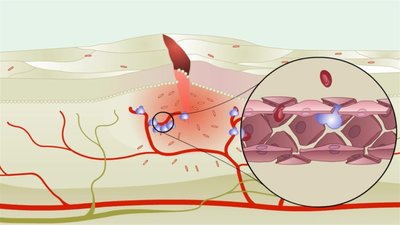 Overview of the inflammatory response with increased blood flow and immune cell recruitment