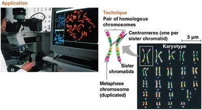 Karyotype analysis and homologous chromosomes
