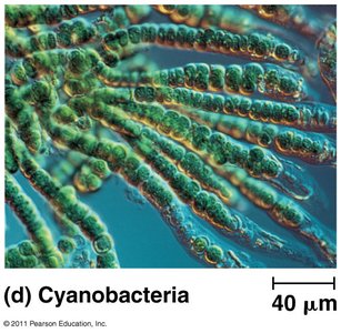 Cyanobacteria under microscope