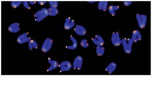Fluorescent image of telomeres at chromosome ends