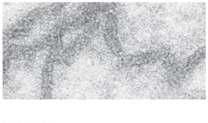 30-nm fiber of chromatin