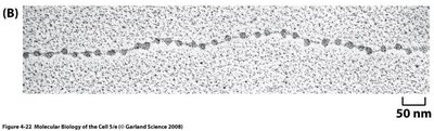 Electron micrograph of beads on a string chromatin structure