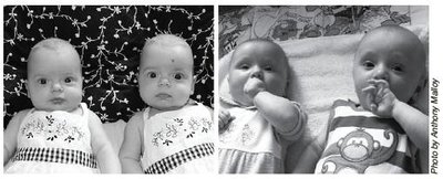 Identical twins illustrating epigenetic differences