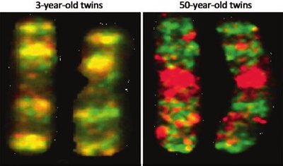 Epigenetic differences in twins at different ages