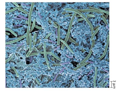 Dental plaque biofilm on teeth