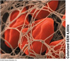 Red blood cells trapped in a fibrin mesh during blood clotting (colorized SEM, 4000x)
