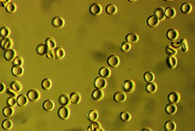 Normal red blood cells