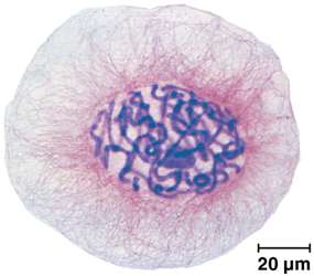 Micrograph of a cell showing chromatin in the nucleus