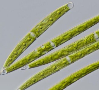 Microscopic image of green algal filaments