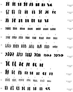 Chromosome comparison between human and chimpanzee
