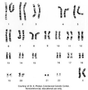 Homologous chromosomes with different alleles