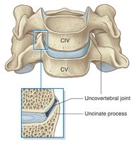 Uncovertebral joints