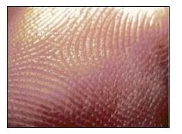 Somatic cells of the skin