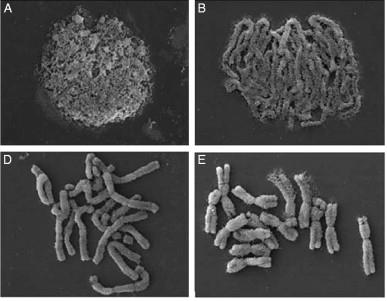 Loosely and tightly compacted chromosomes