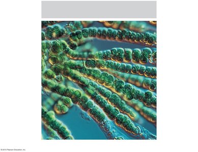 Micrograph of cyanobacteria (photosynthetic bacteria)