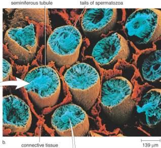 Cross-section of seminiferous tubules showing tails of spermatozoa and connective tissue