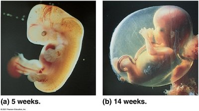 Photographs of human embryos/fetuses at 5 and 14 weeks