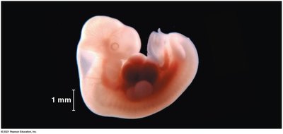 Early human embryo at approximately 1 mm in size