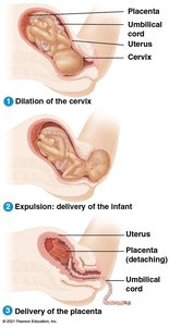 Diagram showing the three stages of labor: dilation, expulsion, and placental delivery