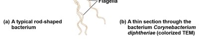 Rod-shaped bacterium and TEM section