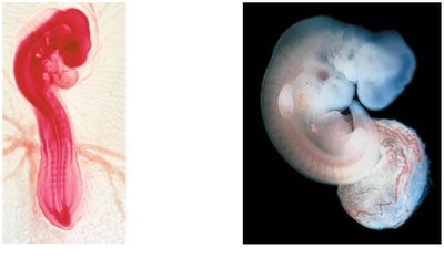 Embryonic homologies: chick and human embryos